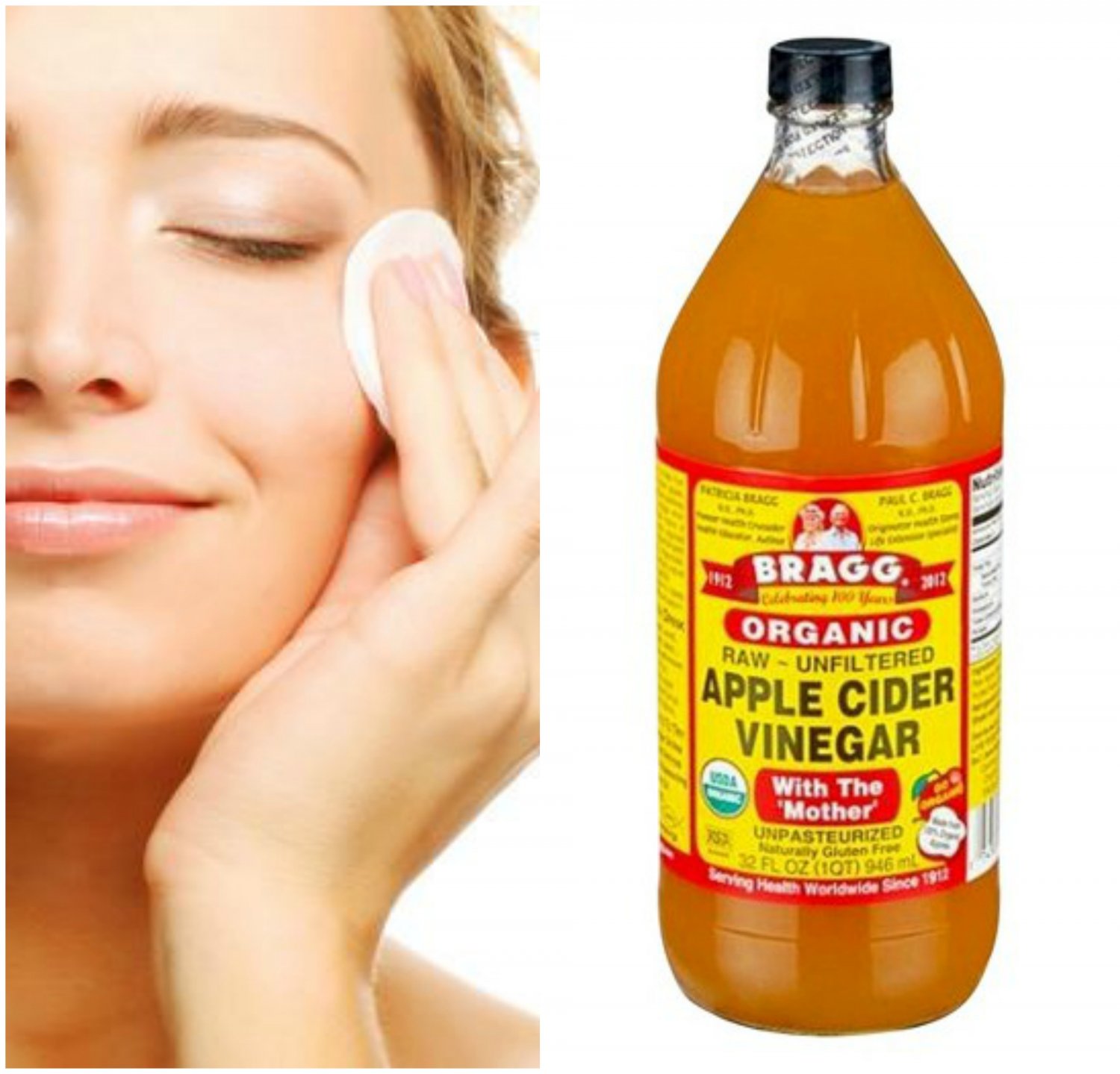 5 Steps To Get Flawless Skin Using ACV